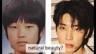 SEVENTEEN HYUNG LINE PLASTIC SURGERY ANALYSIS