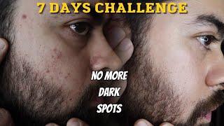 In 7 days Remove Dark Spots *NO CLICKBAIT* 100% REAL RESULTS