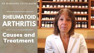 Rheumatoid Arthritis - Causes and Treatment