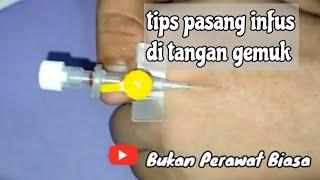 cara pasang infus di tangan gemuk Vena bercabang dan ga terlihat