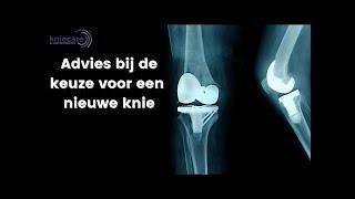 Advies bij de keuze voor een nieuwe knie