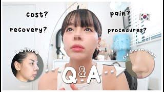 RHINOPLASTY IN KOREA Q&A  post-op 5 months (INDO SUB) | Erna Limdaugh