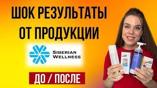 Сибирское здоровье продукция | Отзывы ДО-ПОСЛЕ Siberian Wellness | ШОК РЕЗУЛЬТАТ!