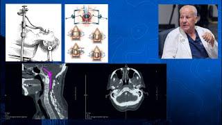 Episode 13 Part 1: Giants of Spine Surgery - Craniocervical Junction Surgery - Volker Sonntag, MD