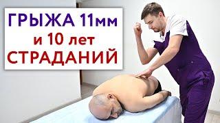11 mm HERNIA and 10 years of SUFFERING. Center them. Yuri Repin. Kostoprav Alexander Fershtat