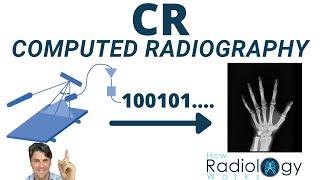 Computed Radiography How it Works (CR Image Receptor)