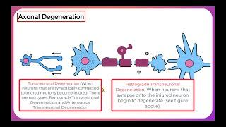 Axonal Degeneration