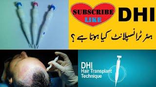 What is DHI hair transplant | Best hair transplant in pakistan | hair problems and solution