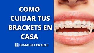 Cómo Cuidar Tus Brackets: Cepillado, Alimentos y Consejos | Diamond Braces