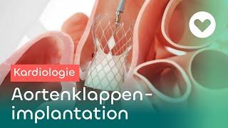 TAVI: Transkatheter-Aortenklappenimplantation - Hightech in der Medizin