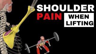 Preventing Shoulder Pain While Lifting