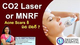 CO2 Laser or MNRFAcne Scars కి ఏది బెటర్ ? Dr Deepthi prasad | Dermatologist | Karimnagar