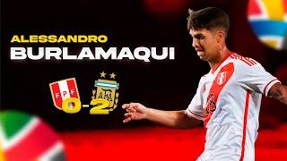 Alessandro Burlamaqui Perú vs Argentina | Pre - Olímpico 2024