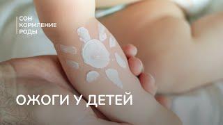 Ожоги у детей