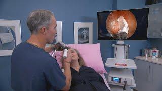 Watch Cryotherapy to Treat Chronic Nasal Congestion