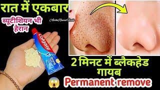 चेहरे के Blackheads, Whiteheads, Open Pores व दाग धब्बों से 100% छुटकारा पाएं | DIY Face Scrub/Mask