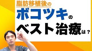 脂肪移植後の顔のボコツキのベスト治療は？