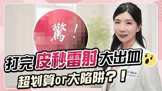 美or痛你選誰？｜打完「皮秒雷射」大出血就是賺到？真實價值大揭秘！｜陳詩珮醫師