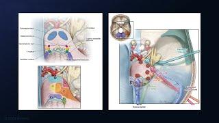 Resection of Middle Peduncular Pontine and Petrosal Cerebellar Cavernous Malformations