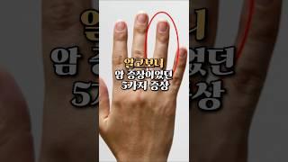 알고보니 암의 증상이었던 의외의 증상 5가지