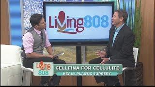 Healy Plastic Surgery: First in Hawaii to get rid of cellulite with Cellfina