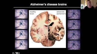 Lab Notes: How Alzheimer’s Starts with Dr Karen Marshall and Dr Mariana Vargas-Caballero