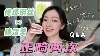 两次正畸超干货经验分享 | Invisalign VS 传统钢丝 | 拔牙 | 牙套脸 | 黑三角 | 保持器 | 整牙必备好物 | Q&A