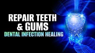 Repair Teeth and Gums | Teeth Regeneration Meditation | Dental Infection Healing Frequency | 432Hz