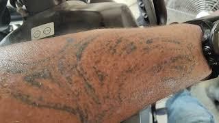 Tattoo removal UPDATE video.