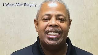 All-on-4 Dental Implant Remakes Anthony's Smile