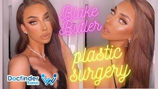 FACIAL FEMINIZATION SURGERY - AMAZING TRANSFORMATION | Blake Butler