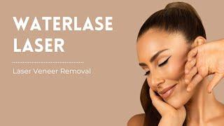 Laser Veneer Removal