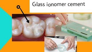 مادة Glass ionomer cement  تفيد المرحلة الثالثة والرابعة والخامسة لطب الأسنان