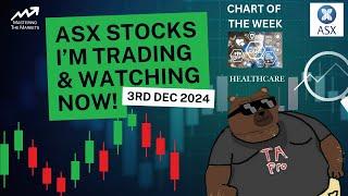 Top ASX Stocks I'm Watching Right Now | December 3rd 2024