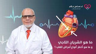 ما هو الشريان التاجي و ما هو أخطر أنواع أمراض القلب ؟ دكتور سامح علام