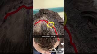 all of nidal’s recent recovery progression updates be truly so inspiring ️‍🩹 #motivation #sad