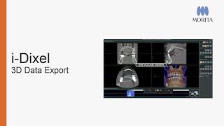 How to export CT data and DICOM series from i-Dixel