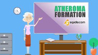 Atheroma Formation | Pathology Animation Video | Medical Online Education | V-Learning™