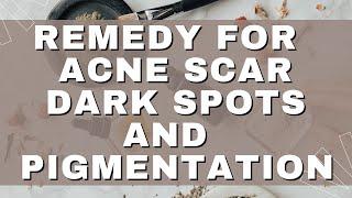 How To Get Rid Of Acne Scar & Dark Spots | Pigmentation | #scor | Pimple Marks | Tried & Tested