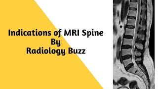 Indications of MRI Spine #radiology #radiology_buzz
