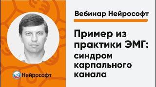 Пример из практики ЭМГ: синдром карпального канала | Вебинар Нейрософт