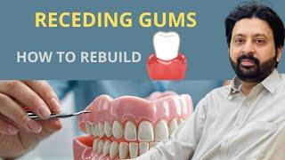 How to Naturally Rebuild Your Gums and Cure Gum Recession