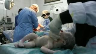 A miracle child - DOCTORS SAVE LIFELESS BABY