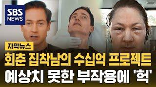 회춘 집착남의 수십억 프로젝트…예상치 못한 부작용에 '헉' (자막뉴스) / SBS