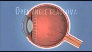 Best Eye Doctors in Hyderabad - Challa Eye Care Centre