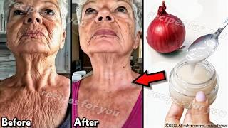 1 onion is a million times stronger than Botox, onion juice for skin wrinkles,onion for face
