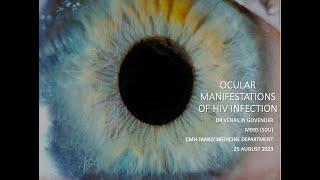 Ocular Manifestations of HIV