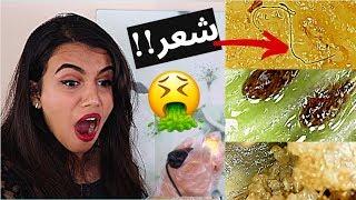 شوفوا كيف شكل الأكل تحت الميكروسكوب | ما رح تصدقوا ايش لقيت !!!