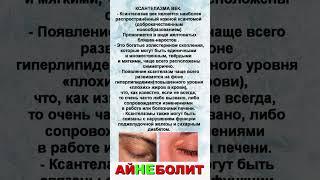 КСАНТЕЛАЗМА ВЕК.