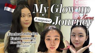 I traveled 7 hours to get 5 surgeries in Korea ... | Jessica's glow up journey at BRAUN! (Part 1)